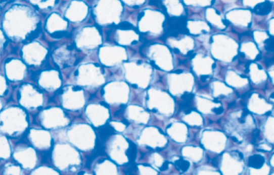 <ul><li><p>Collenchyma cells are grouped in strands and help support young parts of the plant shoot </p></li><li><p>They are living at maturity</p></li><li><p>These cells provide flexible support without restraining growth</p></li><li><p>Celery strings</p></li></ul>