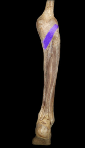 Action:
Lateral rotation of thigh on leg (weight-bearing)
Medial rotation of leg on thigh (non weight-bearing)
Insertion:
Tibia (posterior, proximal shaft)
Innervation:
Tibial nerve