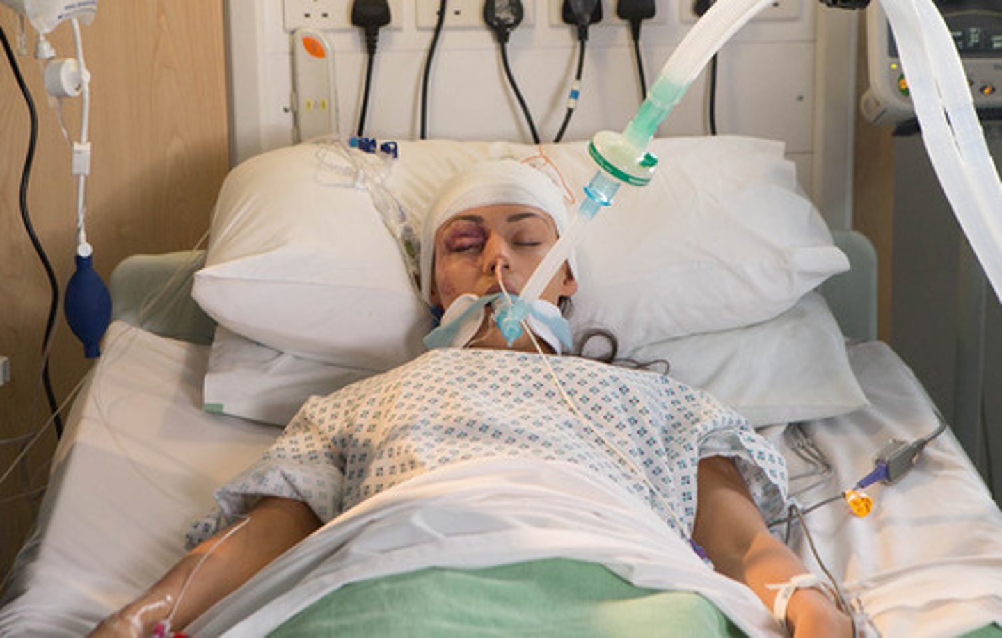 <p>nghiêm trọng</p>