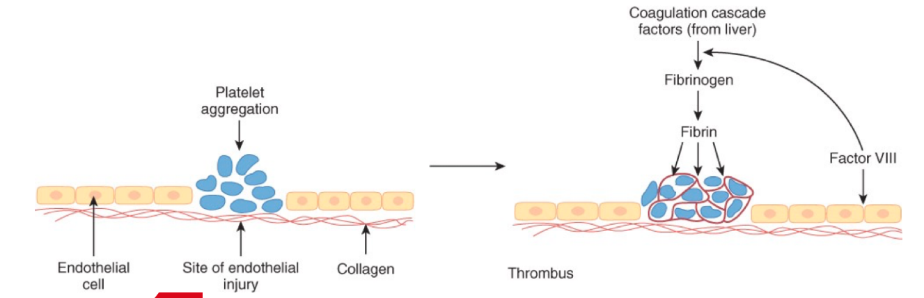 <ul><li><p>blood vessels undergo spastic contraction</p></li><li><p>blood shunted to non-injured vessels</p></li><li><p>platelets </p><ul><li><p>physically obstruct BF</p></li><li><p>promote vasoconstriction</p></li><li><p>release chemical = further hemostatic process </p></li><li><p>fibrinogen → fibrin monomer</p><ul><li><p>polymerizes = thrombus = clotting cascade (from liver) </p></li></ul></li><li><p>inhibitors slow rxn</p></li><li><p>cascade designated by roman numerals </p></li></ul></li></ul><p></p>