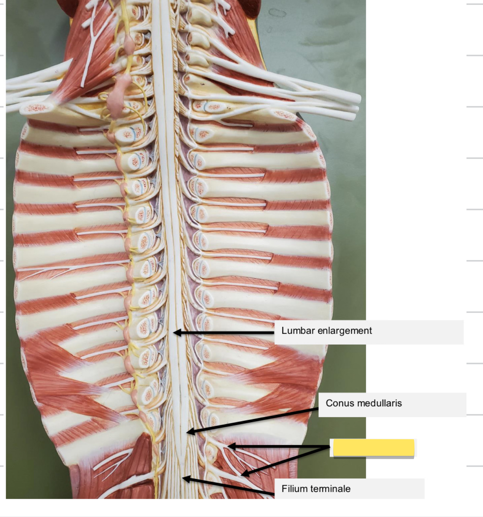 <p> Name this part</p>