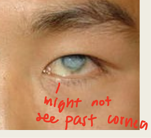 <ul><li><p><span>shrinkage and disorganization of the eye; </span><em><span>functional loss</span></em><span> of eye</span></p></li><li><p><strong><span>Cause</span></strong><span> by: trauma, surgery, infection, inflammation, malignancy, retinal detachment or vascular lesion</span></p></li><li><p><strong><span>Presentation</span></strong><span>: eye will have a square shape</span></p><ul><li><p><span>Cornea will be thick and </span><em><span>opaque</span></em><span>, white</span></p></li><li><p><span>Sclera will be thickened</span></p></li><li><p><span>Iris neovascularization</span></p></li><li><p><span>Bad cataract</span></p></li><li><p><span>Retinal detachment</span></p></li></ul></li><li><p><strong><span>Treatment</span></strong><span>:</span></p><ul><li><p><span>Cosmetic rehabilitation = fit w/ prosthetic shell</span></p></li><li><p><span>Pain management (meds depend on cause)</span></p></li></ul></li></ul><p></p>