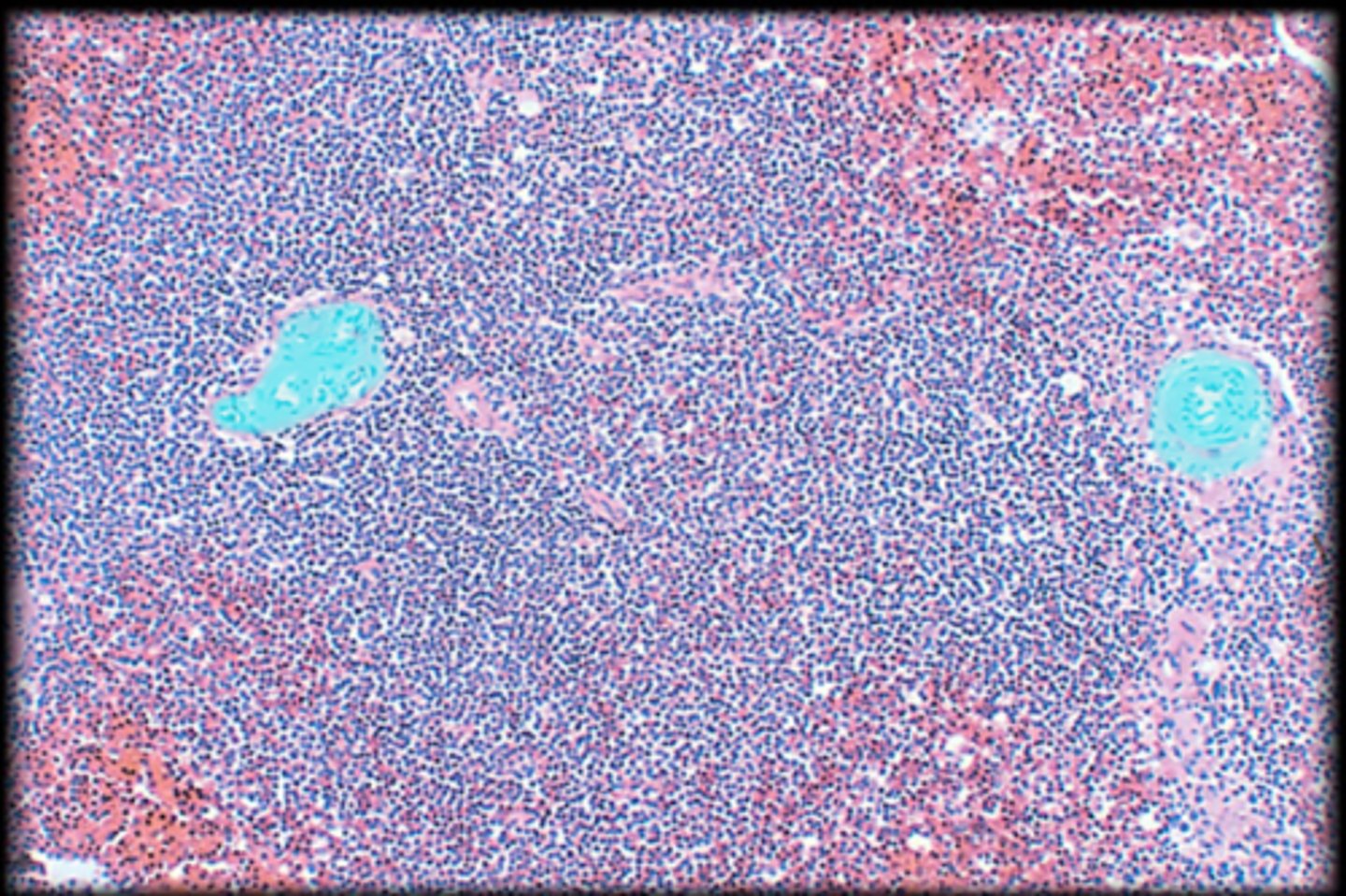 <p>Spleen</p>