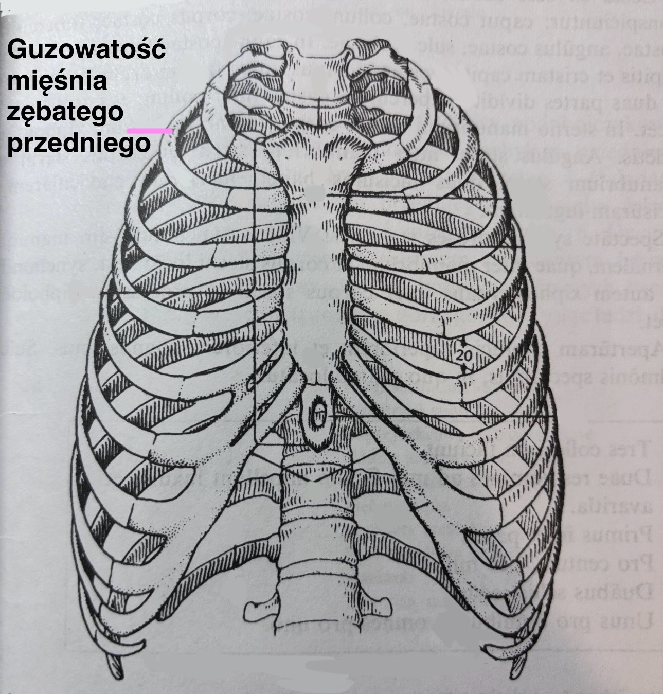 <p>Tuberositas musculi serrati anterioris</p>