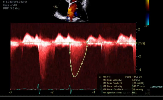 <p>what measurement would this be </p>