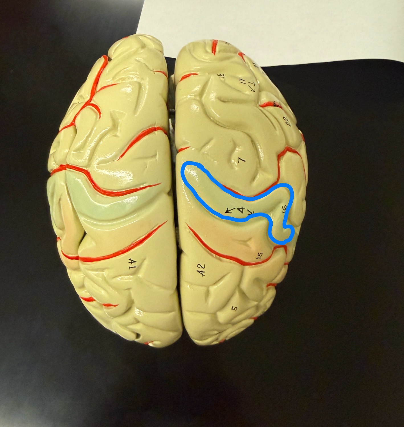 <p>What is outlined in blue on the brain model?</p>