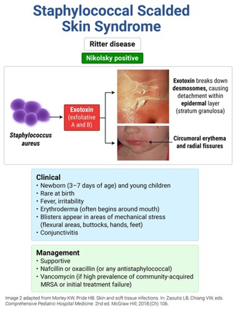 <p>SSSS (Ritter disease) → MC &lt; 5y</p><p>oatmeal = "SSSS sad face"</p><p>tx = nafcillin or oxacillin (vanco if MRSA); steroids are CI!!</p>