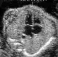 <p><span style="line-height: 21.6px;"><strong>Evaluate fetal situs</strong>; what is the presentation of the image?</span></p>