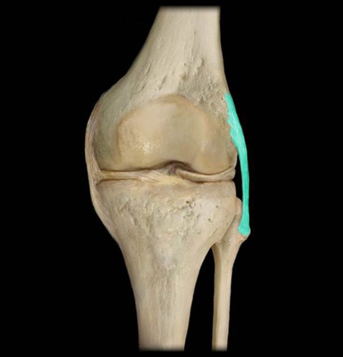 <p>- extends from lateral epicondyle of femur to head of fibula</p><p>- prevents lateral rotation when the knee is extended</p><p>- can see in anterior and posterior views</p>