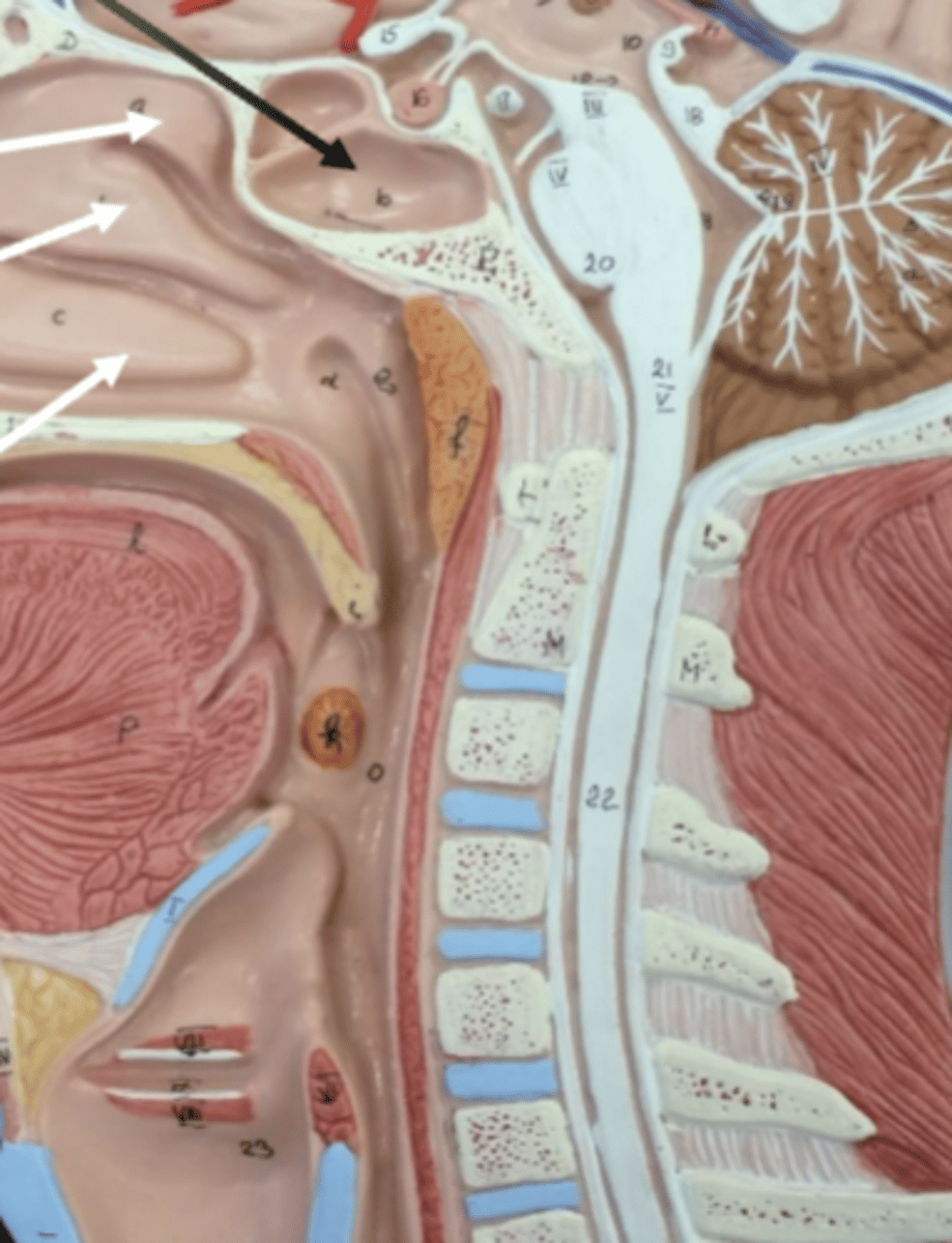 <p>the nasal concha.... superior, middle and inferior going from top down</p>