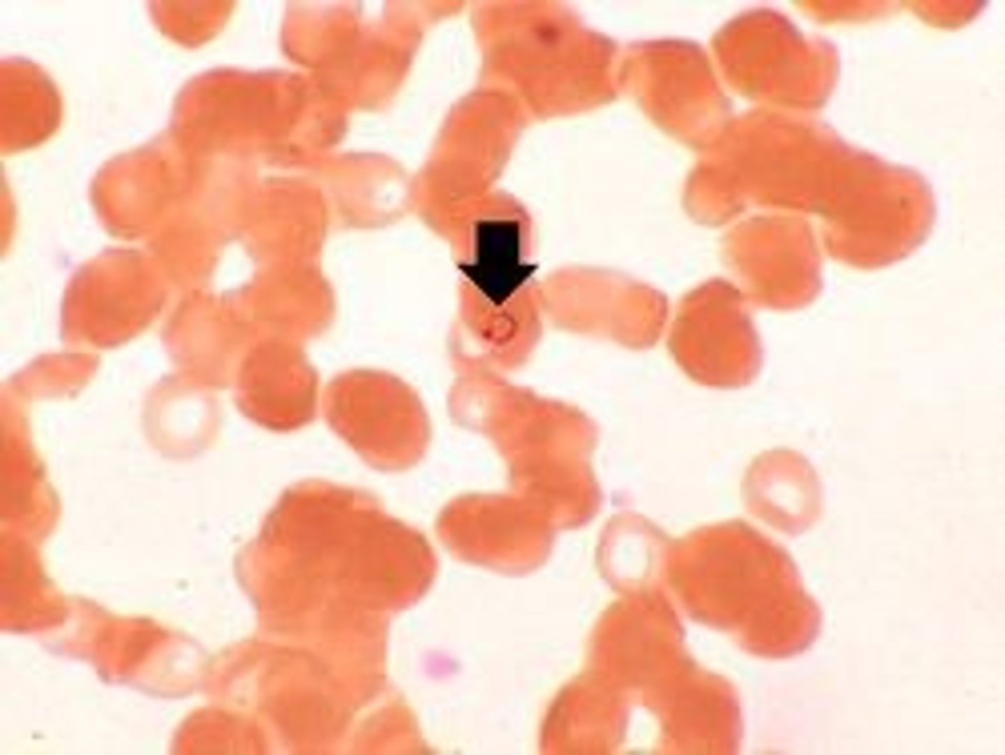 <p>-Malaria transmitted by mosquitoes</p><p>- Trophozoite: IDs for malaria</p><p>reddish/purple signet ring</p><p>-Schizont: reddish/purple clumps</p><p>Gametocyte: shaped like a banana</p>