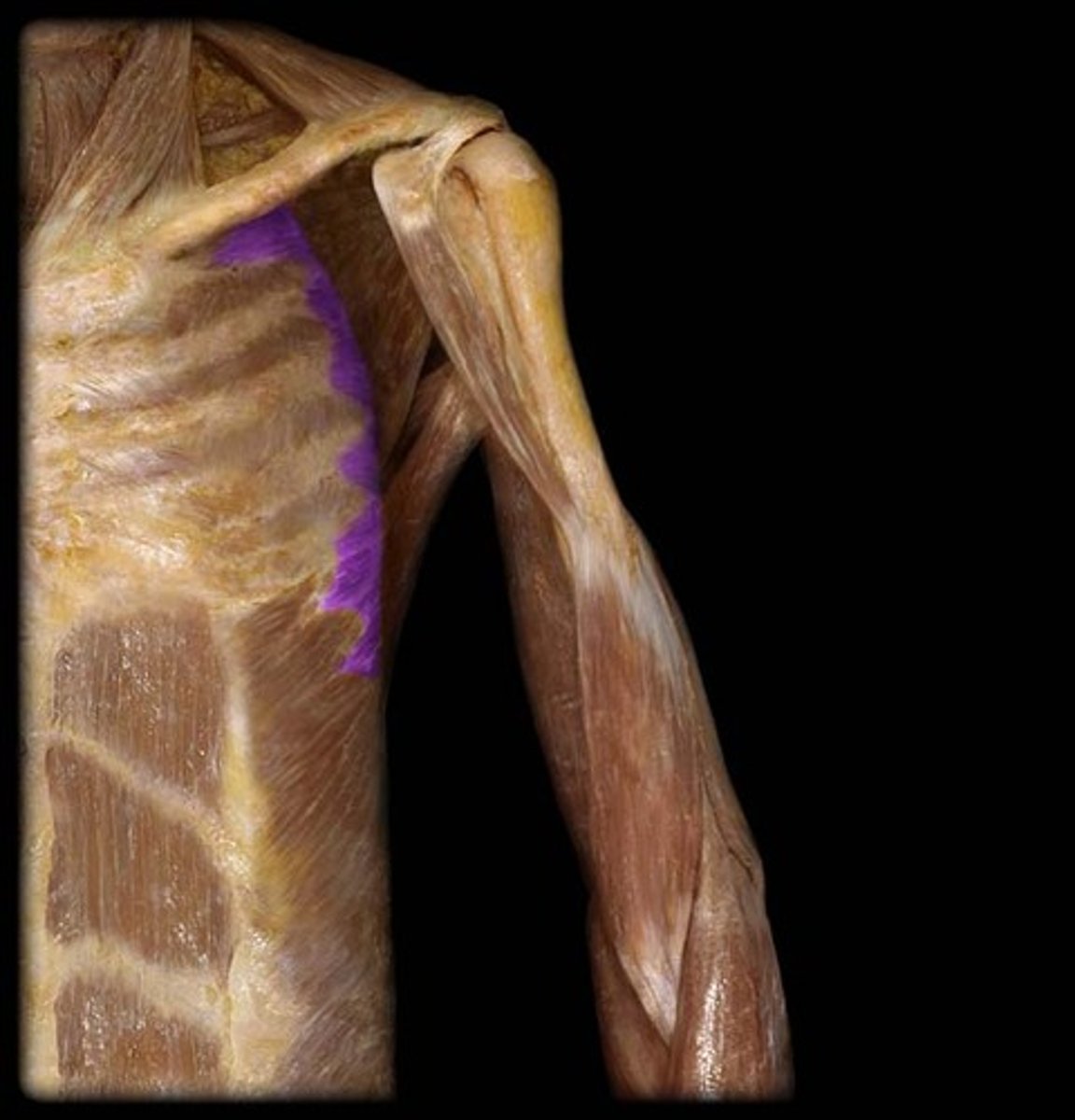 <p>What is this muscle, and what is its action, Proximal &amp; Distal insertions?</p>