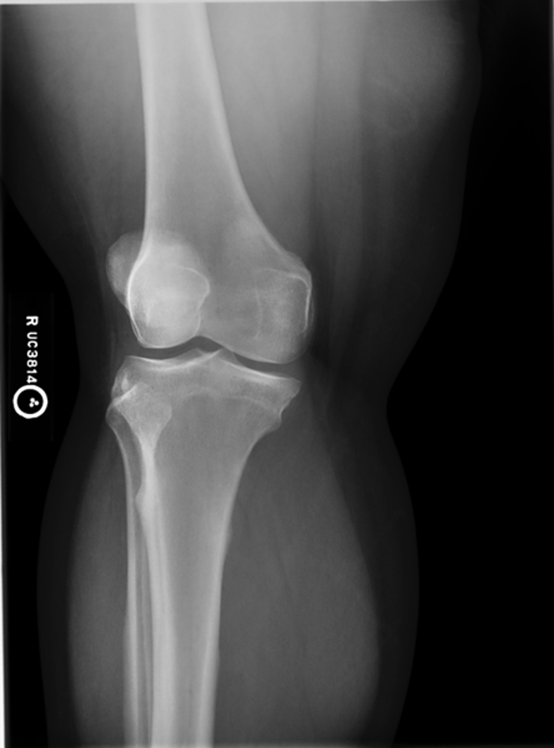 <p>what is the critique of this lateral oblique?</p>