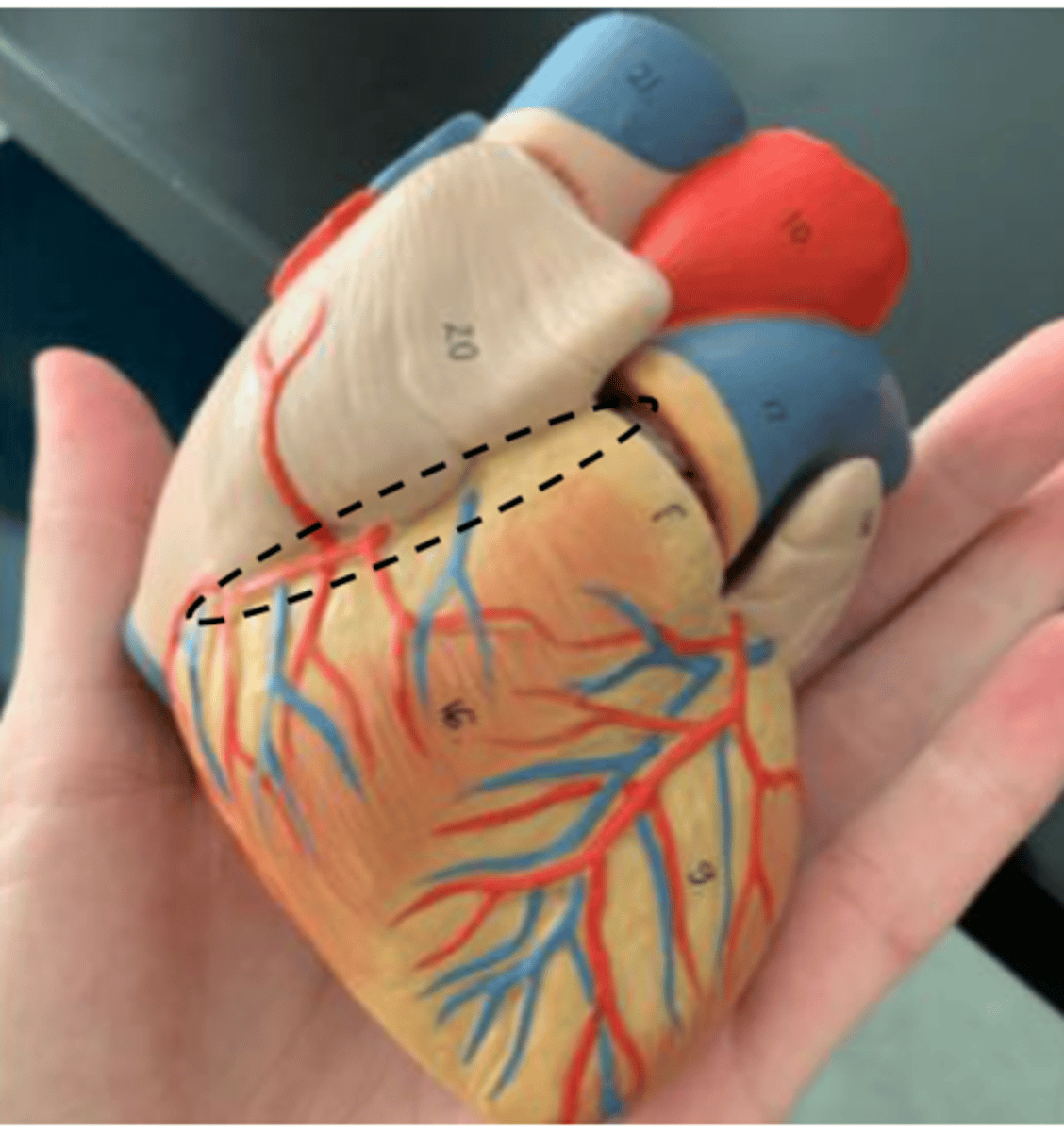 <p>AKA (atrioventricular sulcus)</p>