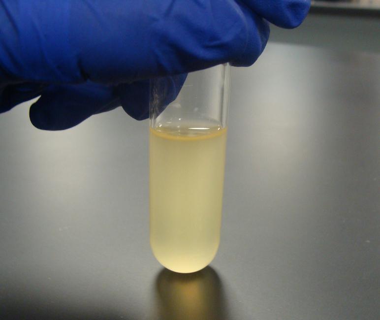 <p>Does this tube have growth? If yes, what is it called?</p>
