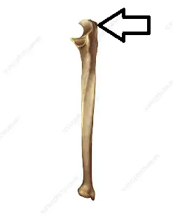 <p>what part of the ulna is this?</p>