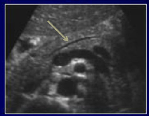 <p>What is this image pointing to?</p>