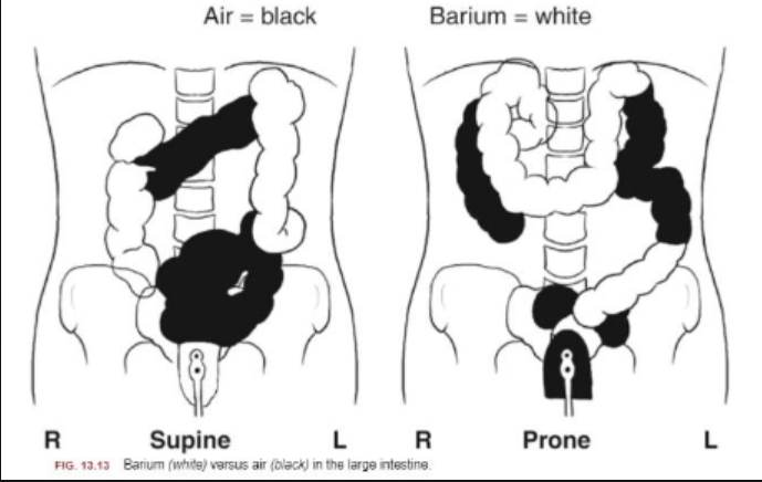 <p>Describe which contain air and barium.</p>