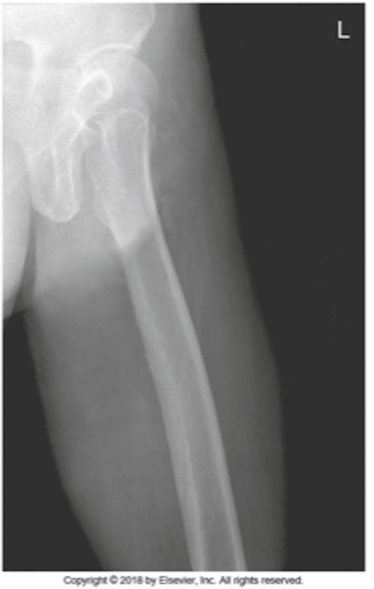 <p>- Proximal femur not superimposed</p><p>- True lateral</p>