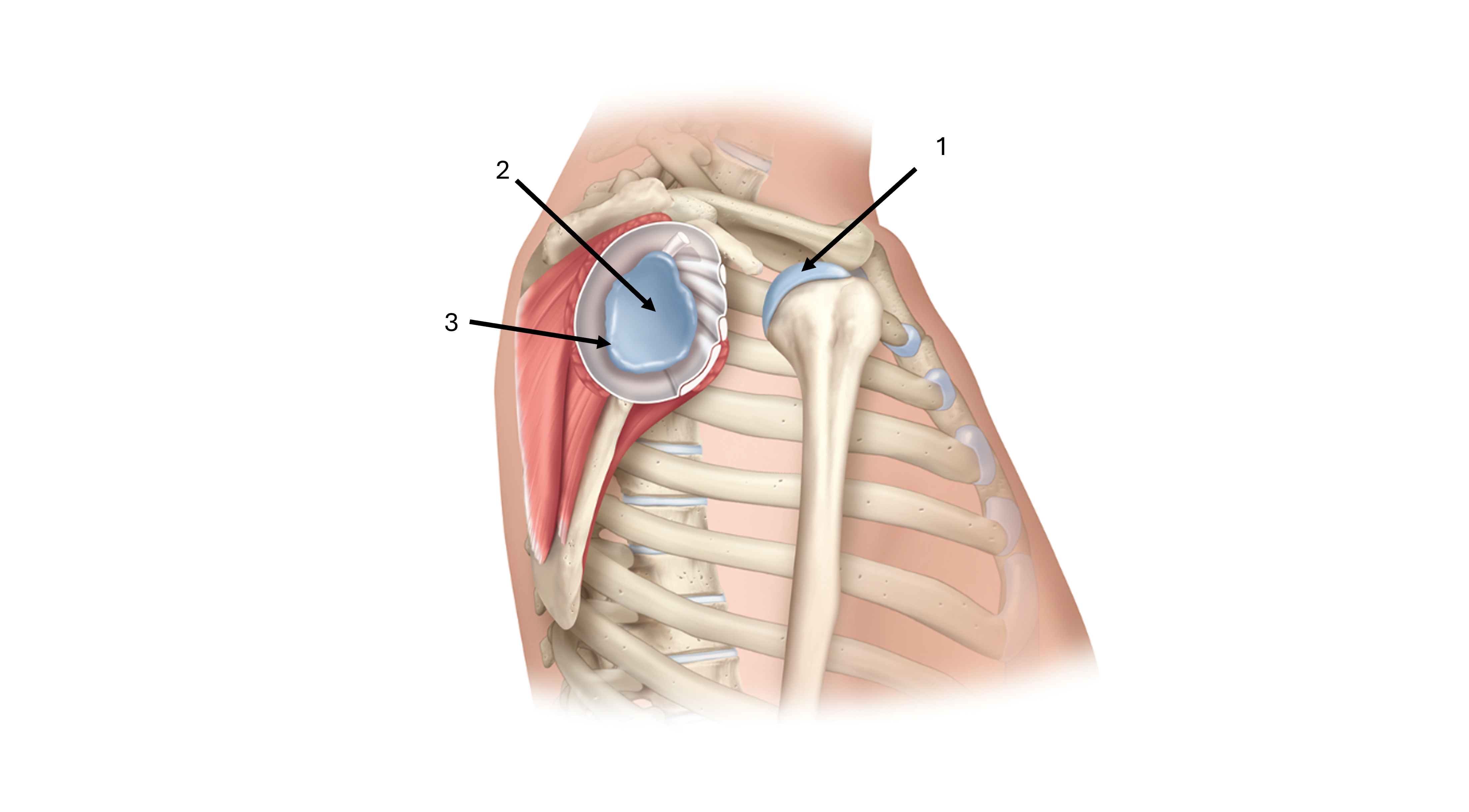 <p>what is label #1</p>