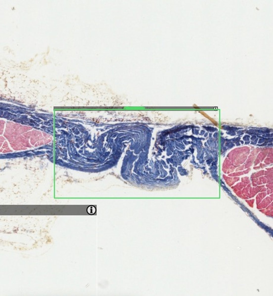 <p>What tissue type is shown as a whole?</p><p>What structure does it compose?</p>