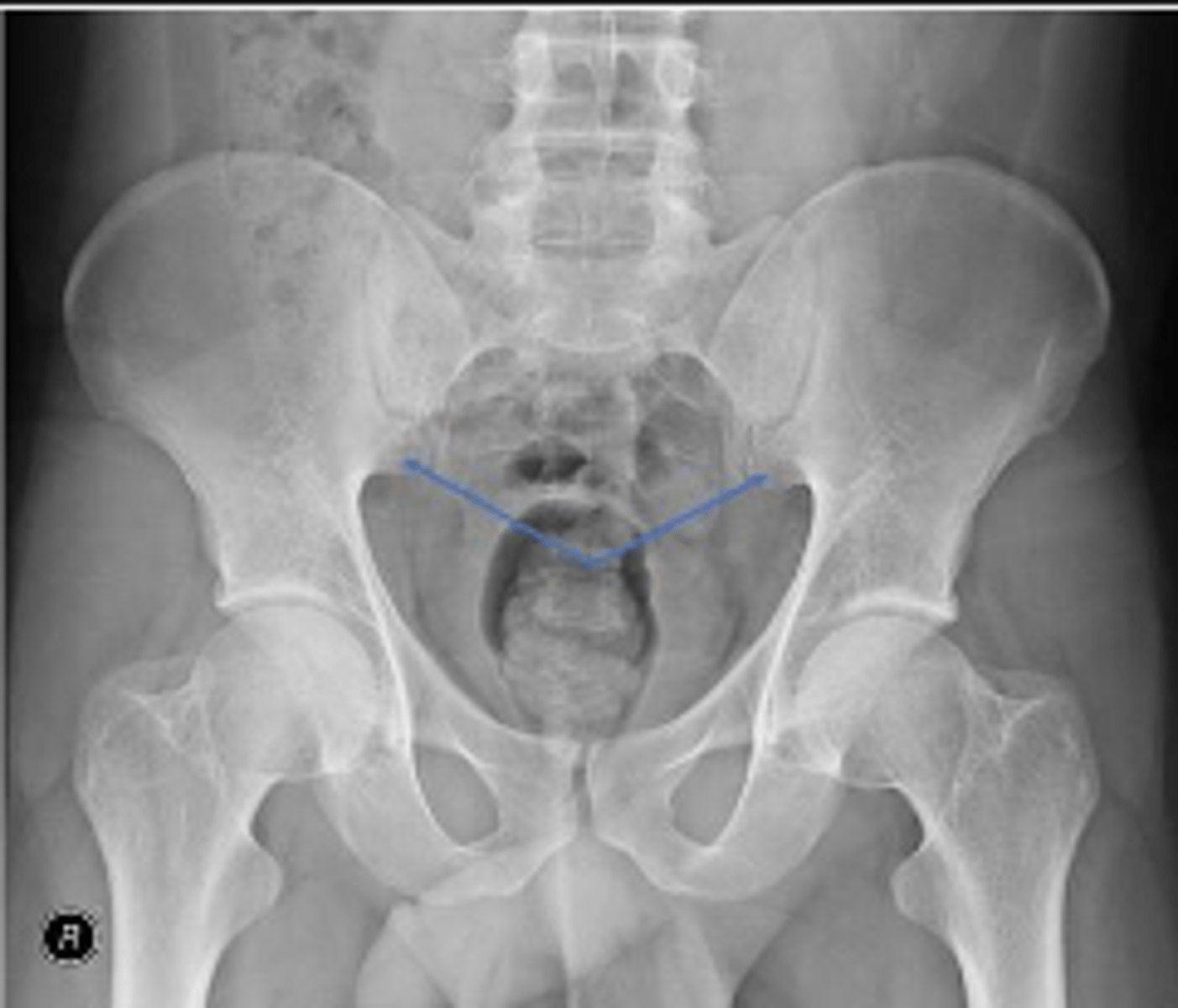 <p>What are the arrows pointing to?</p>