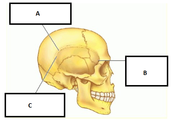 <p>A. Which temporal bone marking is this? (2)</p>