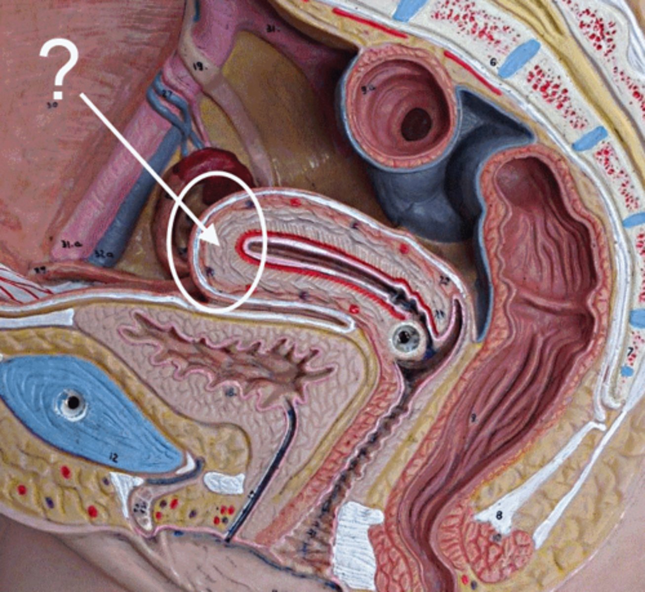 <p>Upper, rounded part of the uterus.</p>