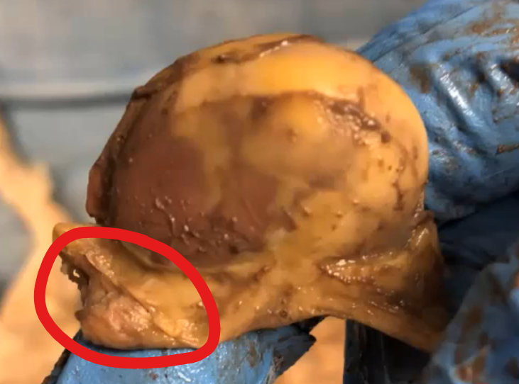 <p>Top is a kidney<br>Circle (rabbit)</p>