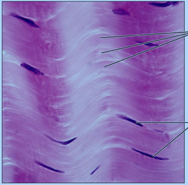 <p>dense regular</p>