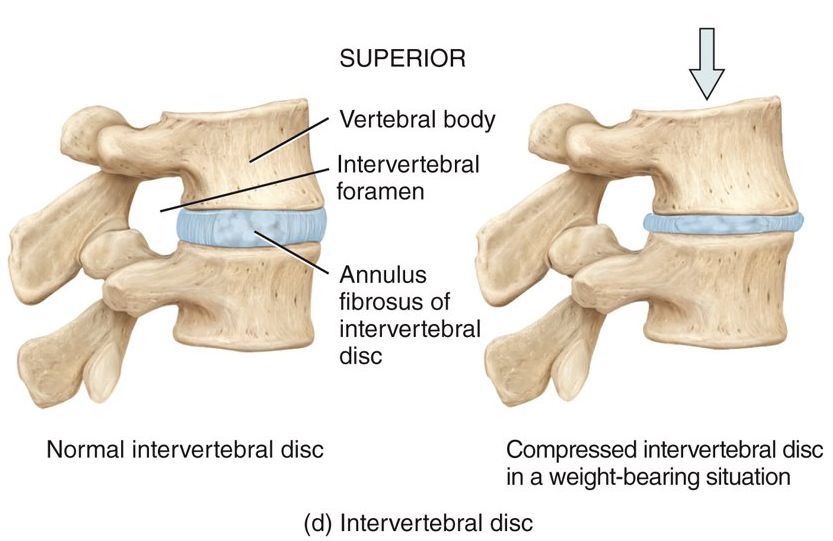 <p>located between the bodies of the vertebrae from the second cervical to the sacrum</p>