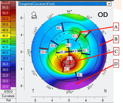 <p><span>Look at the attached topography. &nbsp;What does point C describe?&nbsp;</span></p>