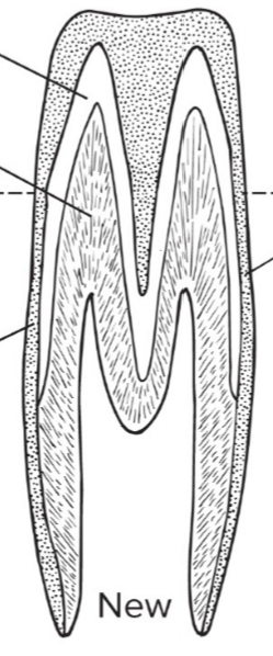 <p>What type of tooth is this?</p>