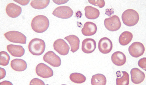 <p>what is a codocyte (target cell)?</p>