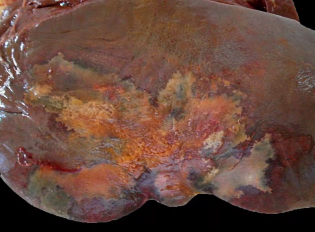<p>What is a predisposing factor?</p><p>A-Moniezia expansa</p><p>B-Haemonchus contortus</p><p>C-Fasciola hepatica</p><p>D-Dicroelium dendriticum</p>