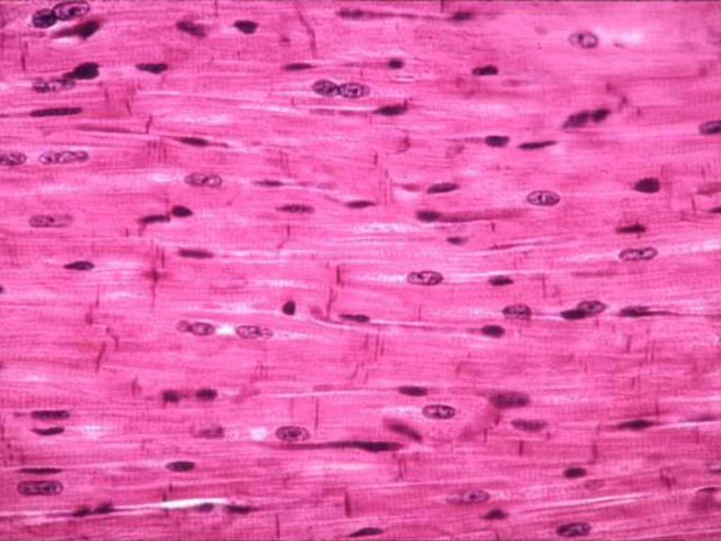 <ul><li><p>Consists of striated, branching fibers</p></li></ul><p>→ Typically has one nucleus but SOMETIMES has two nuclei</p><ul><li><p>Join end-to-end via <strong><u><mark data-color="yellow" style="background-color: yellow; color: inherit;">intercalated discs</mark></u></strong>&nbsp;</p></li></ul><p>→ Contain <strong><u><mark data-color="yellow" style="background-color: yellow; color: inherit;">desmosomes</mark></u></strong> (strengthen &amp; hold fibers together during contractions) &amp; <strong><u><mark data-color="yellow" style="background-color: yellow; color: inherit;">gap junctions</mark></u></strong> (facilitate quick conduction of electrical signals)</p><ul><li><p><strong><u><mark data-color="yellow" style="background-color: yellow; color: inherit;">Location:</mark></u></strong> Heart wall&nbsp;</p></li><li><p><strong><u><mark data-color="yellow" style="background-color: yellow; color: inherit;">Functions:</mark></u></strong> Pumps blood to all parts of the body&nbsp;</p></li></ul><p></p>