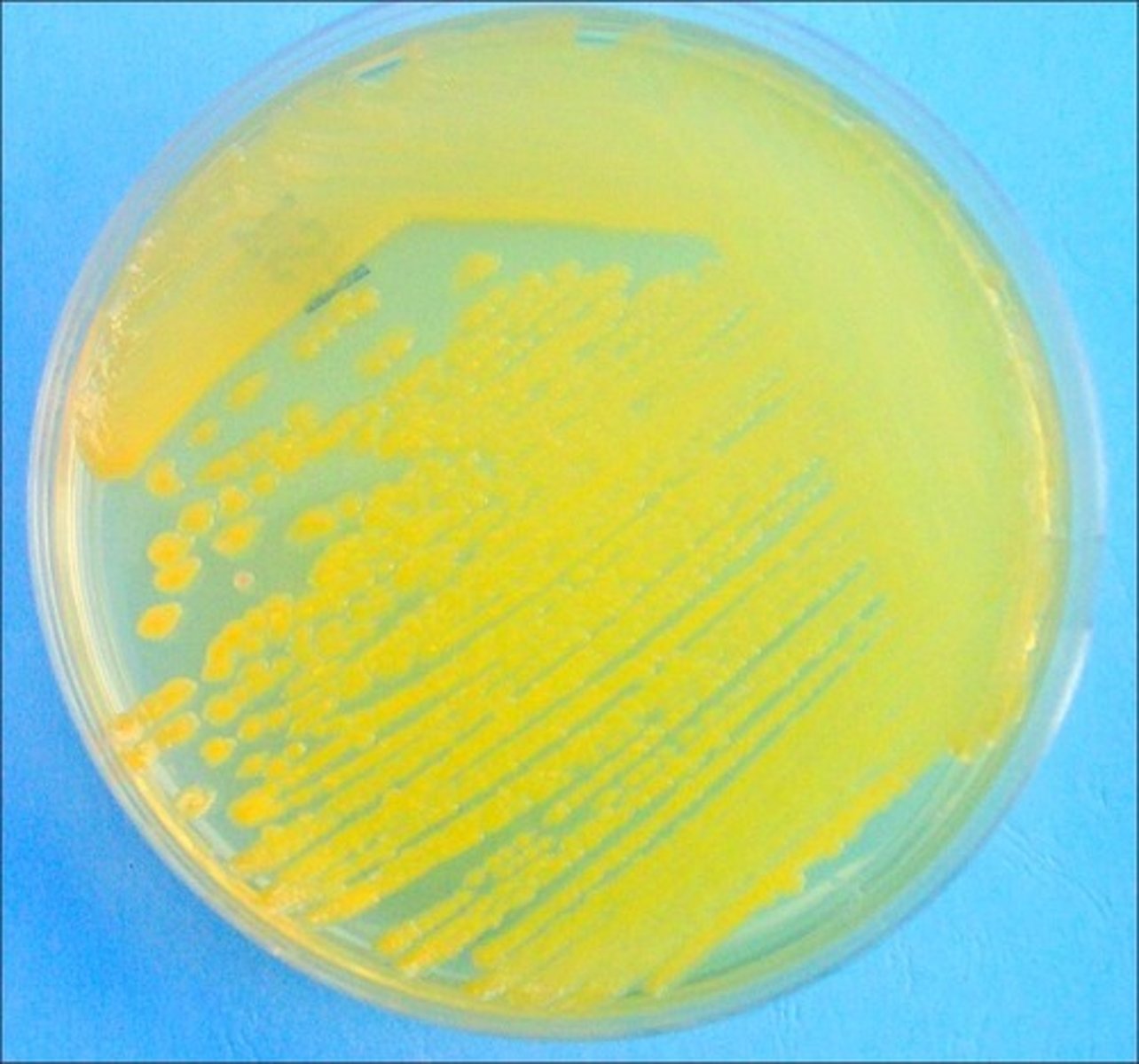 <p>Error in streaking:</p>