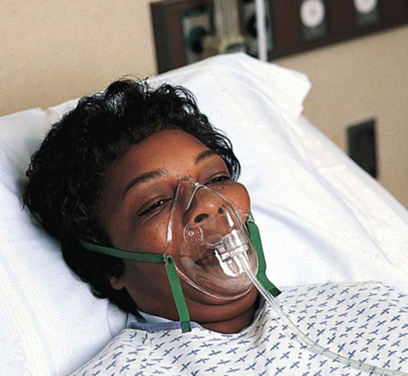 <p>A) Oxygen mask</p>