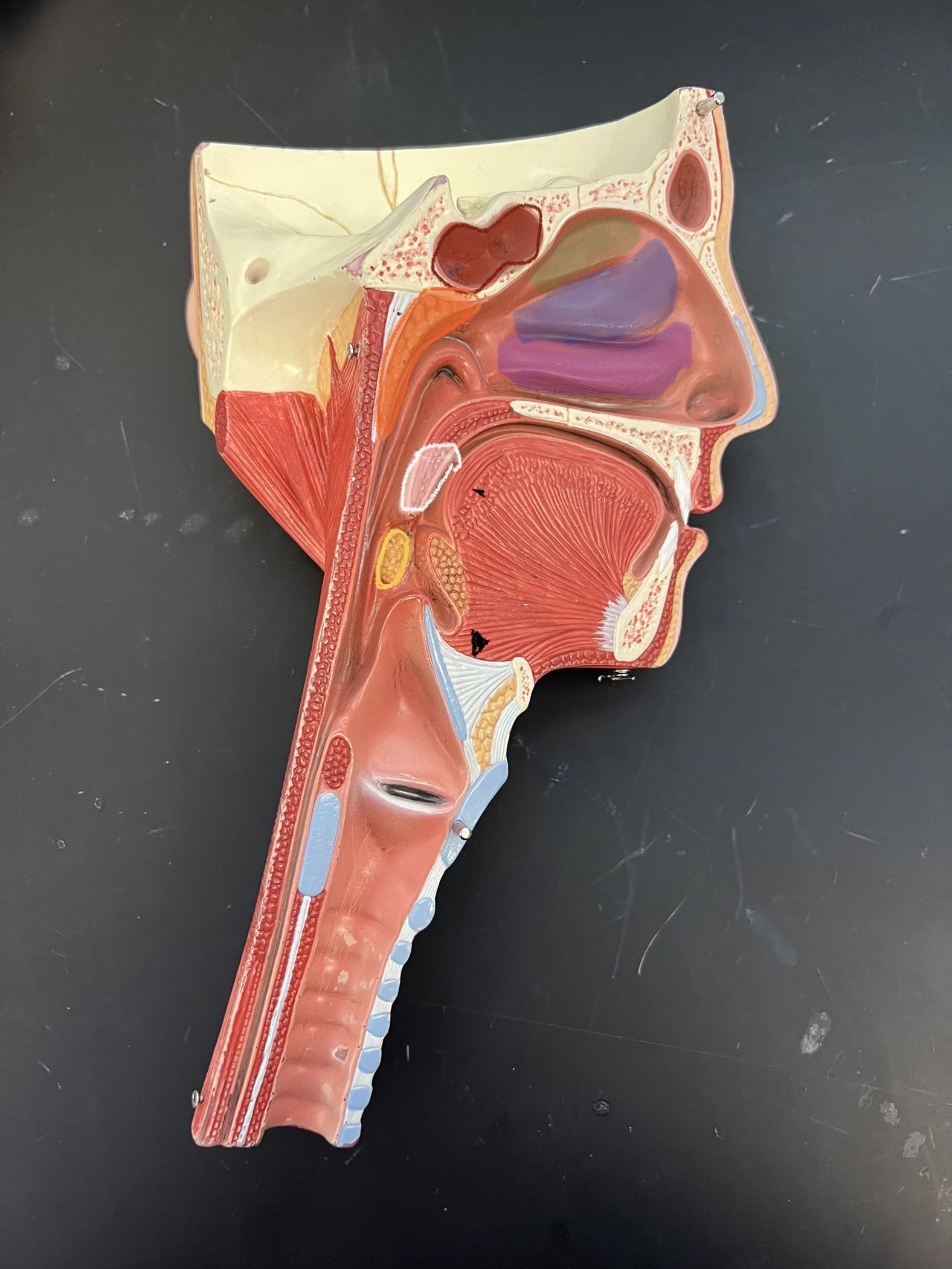 <p>What structure sits between the blue and purple highlighted bones?</p>