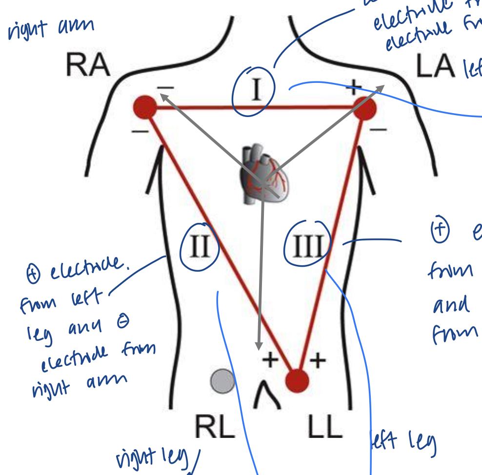 <ul><li><p>RA (right arm): lead II - and lead I -</p></li><li><p>LA (left arm): lead I + and lead III -</p></li><li><p>LL (left leg): lead II + and lead III +</p></li><li><p>RL (right leg): reference electrode for recording purposes</p></li></ul><p></p>