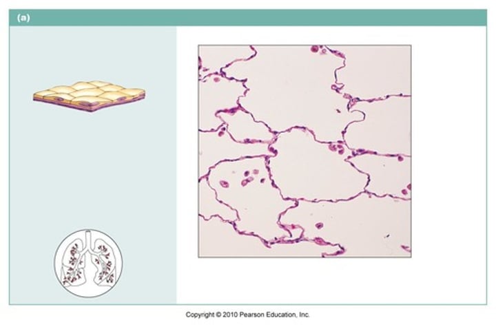 <p>name the type of epithelial tissue</p>