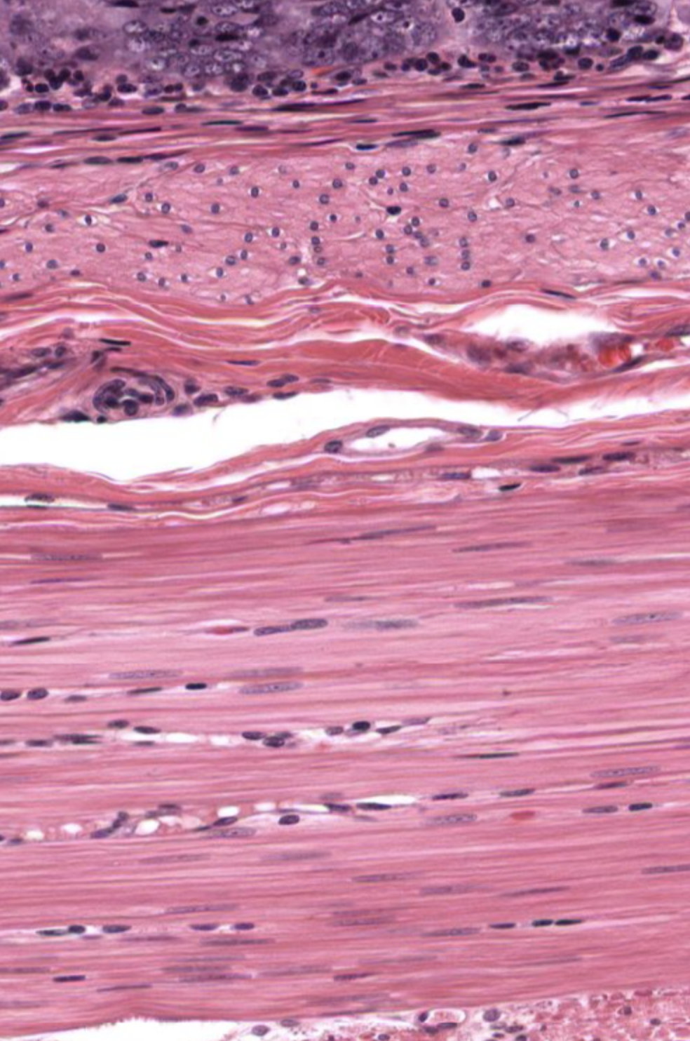<p>Muscle tissue that is pindle-shaped (fusiform), have a single, centrally located nucleus, and are under involuntary control. Uniform, nonstriated appearance. It helps with digestion and nutrient collection, and rids the body of toxins and works in electrolyte balance</p>