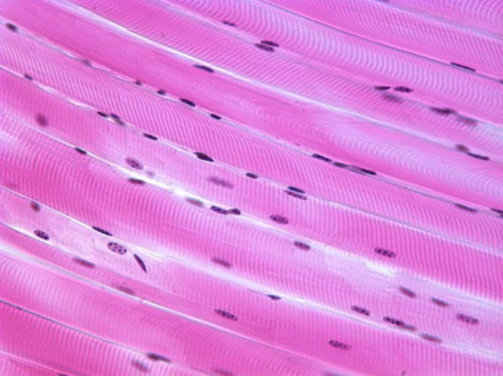 <p>Identify this tissue type.</p>