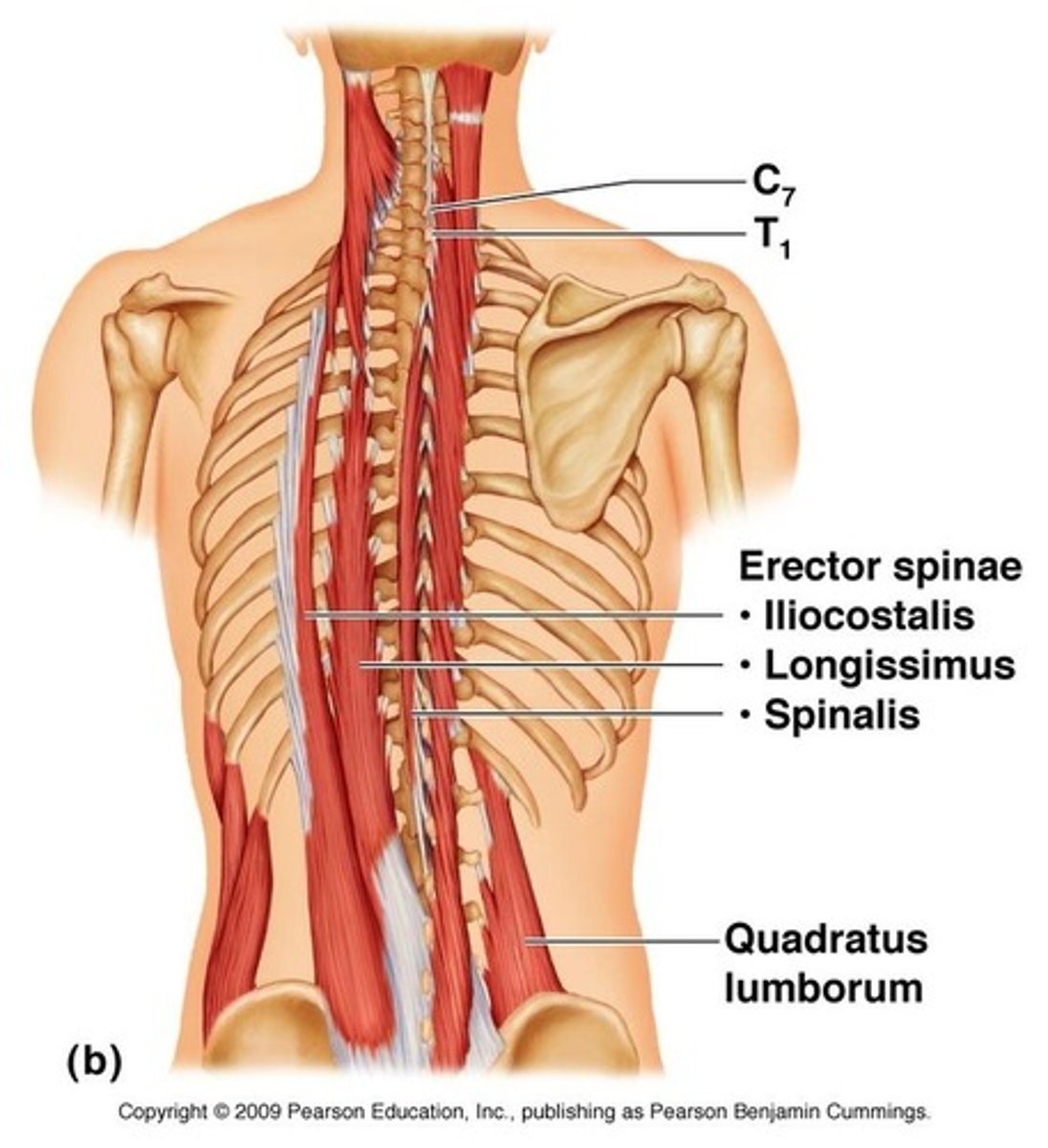 <p>- iliocostalis</p><p>- longissimus</p><p>- spinalis</p>