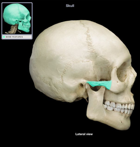 <p>cheek bone and side of eye socket</p>