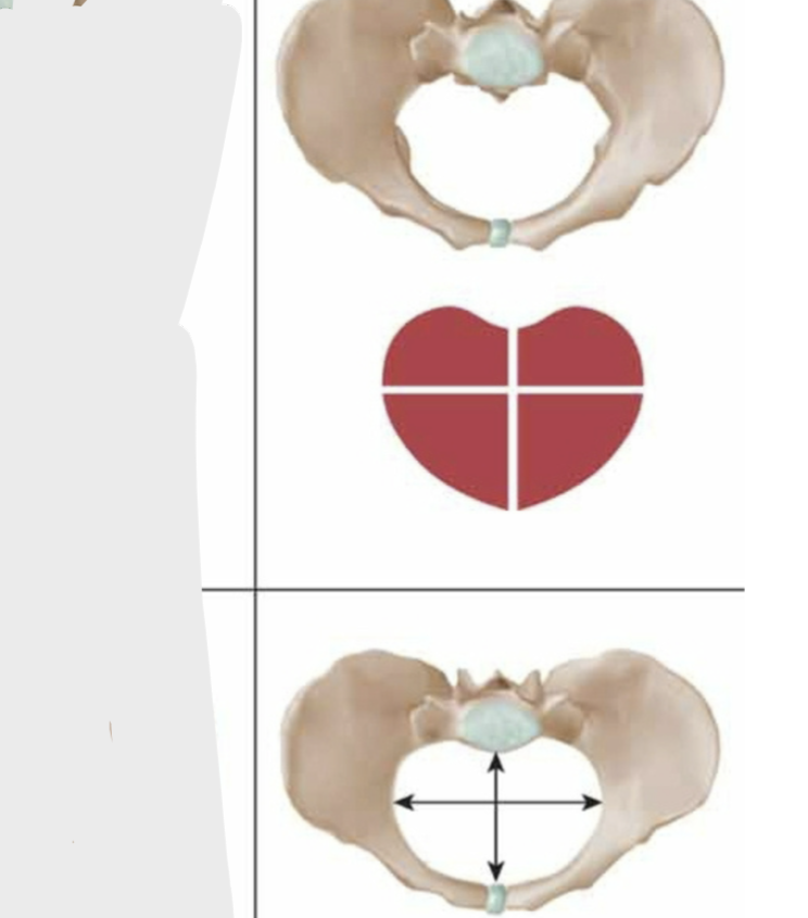 <p>flat w/ incidence of 5%;<strong> transverse oval shape</strong>; delay of descent at inlet common; c/s common</p><ul><li><p><strong>not favorable for vaginal birth</strong></p></li></ul><p></p>