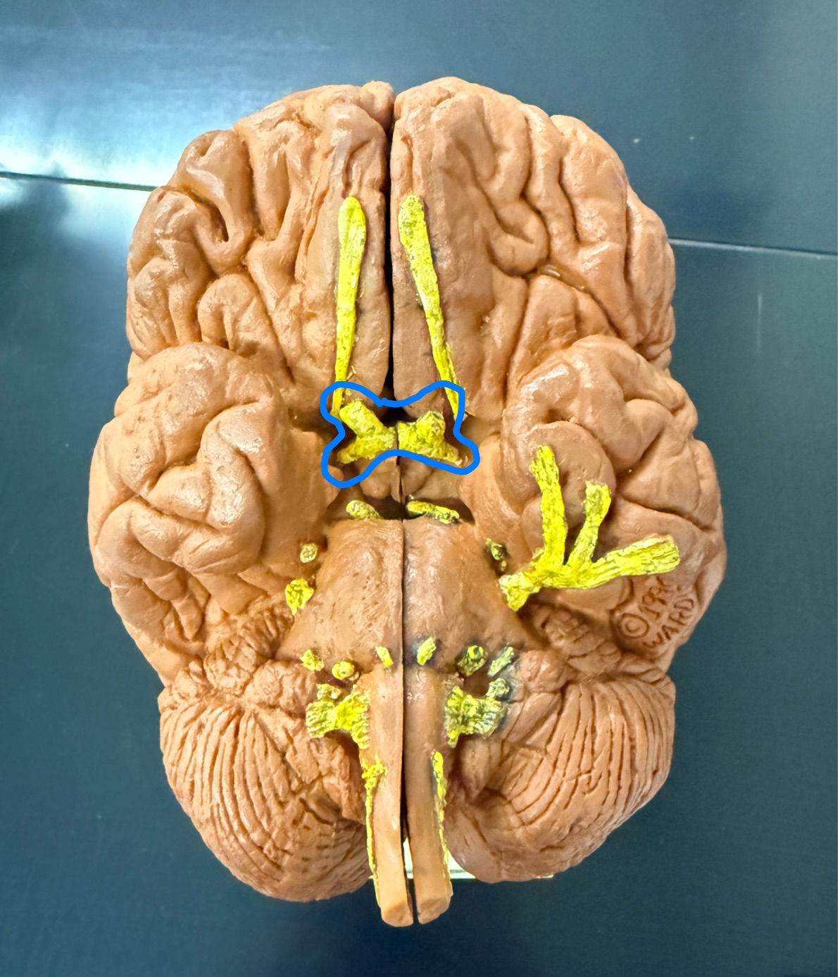 <p>What is this named in brain terms (not cranial nerve)? </p>
