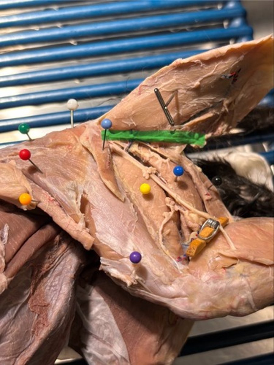 <p>What thigh muscle is the highlighted green</p>