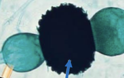 <p>What is this? Is it young or mature?</p>