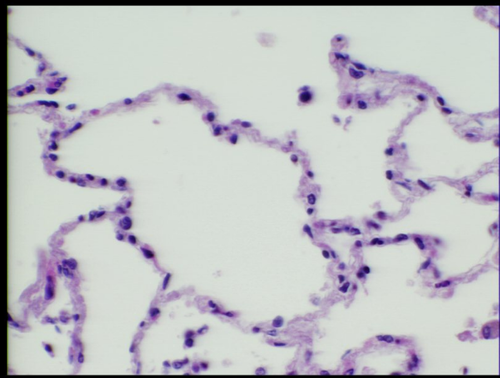 <p>simple squamous epithelium </p><ul><li><p>type 1 large flattened cells</p></li></ul><ul><li><p>type 2 little round cells that secrete surfactant</p></li></ul><p></p>